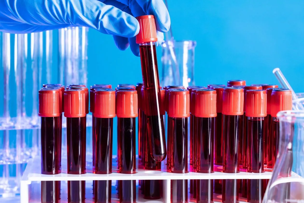 Hydroxypropyl Starch Derivatives: Applications in Industry and Hair Care